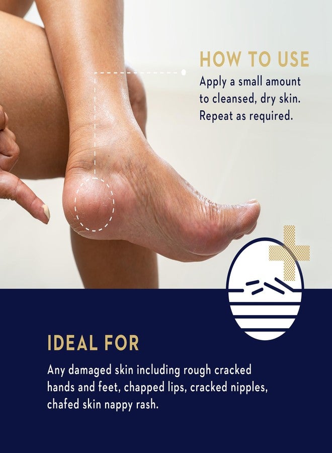 Manuka Health Manuka Rescue Balm - Medical Grade Manuka Honey Wound Care with Aloe, Beeswax & Calendula – Fast Acting, Long Lasting Care for Stressed & Rough Skin, 1.69oz​ - Image 4